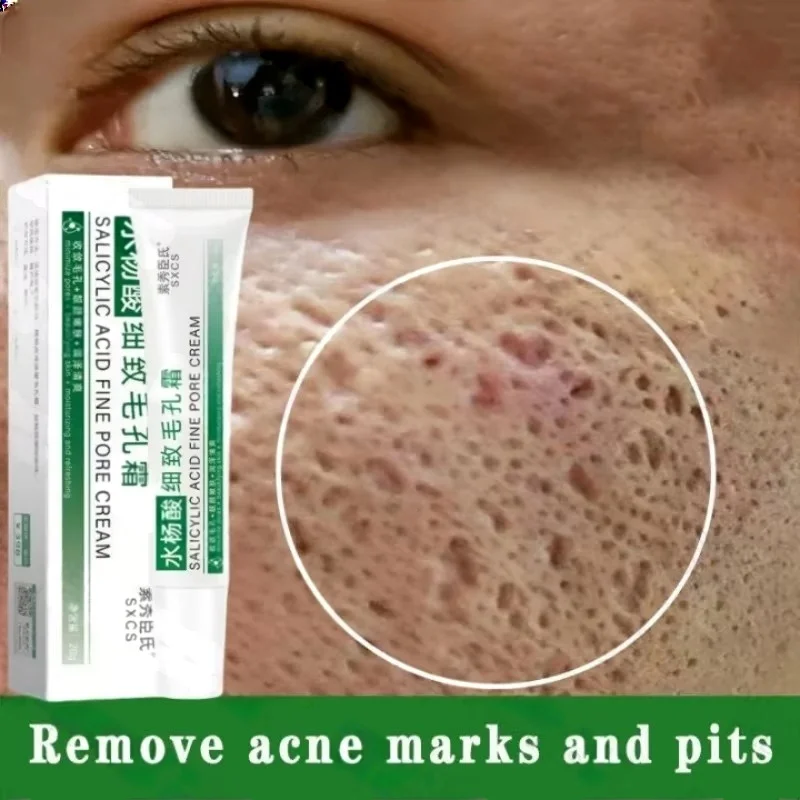 Salicylzuur Porie Clearing Cre - Korean Skincare Routine recensie en prijs